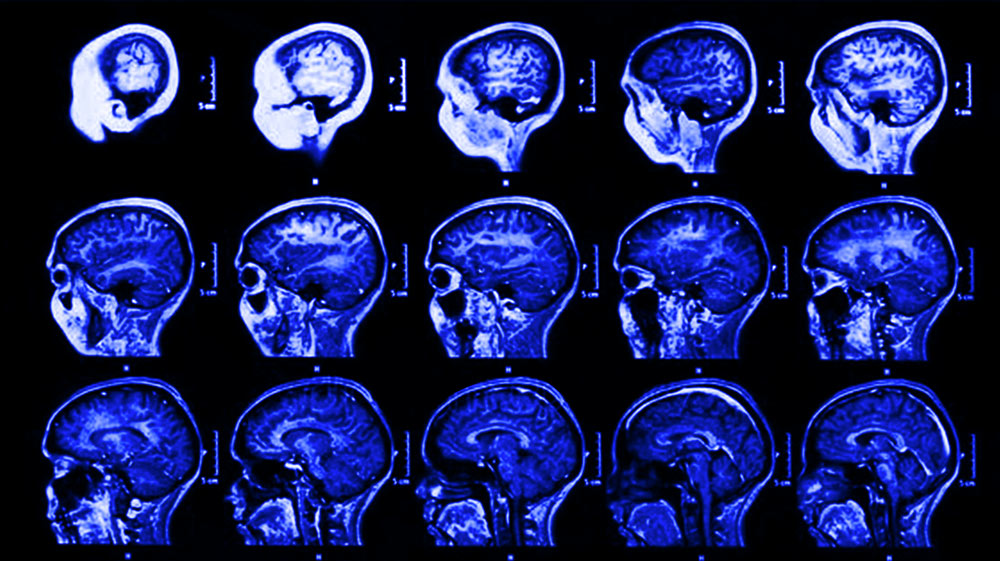 cerveaux dopamine unsplash